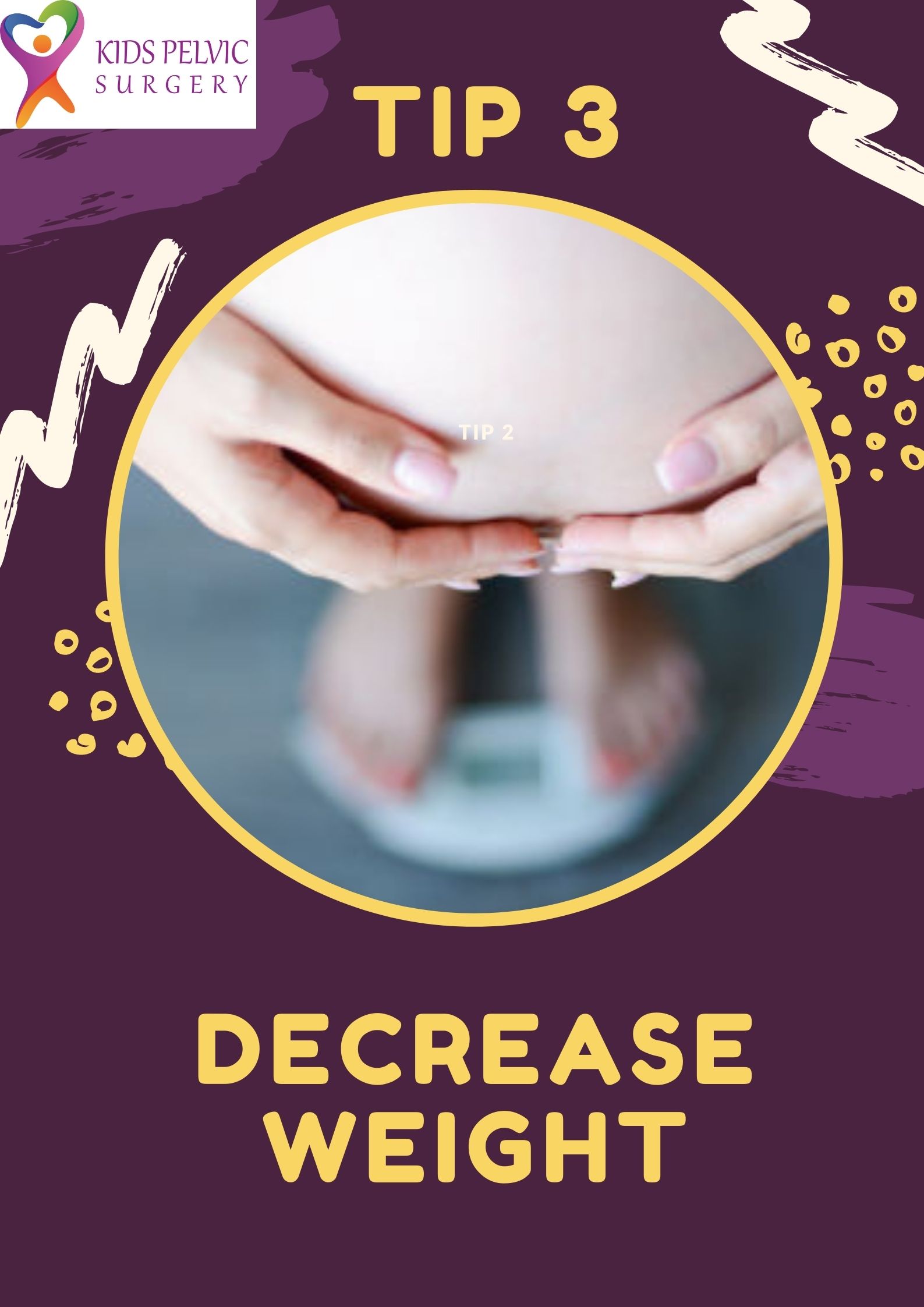 obesity Hypospadias