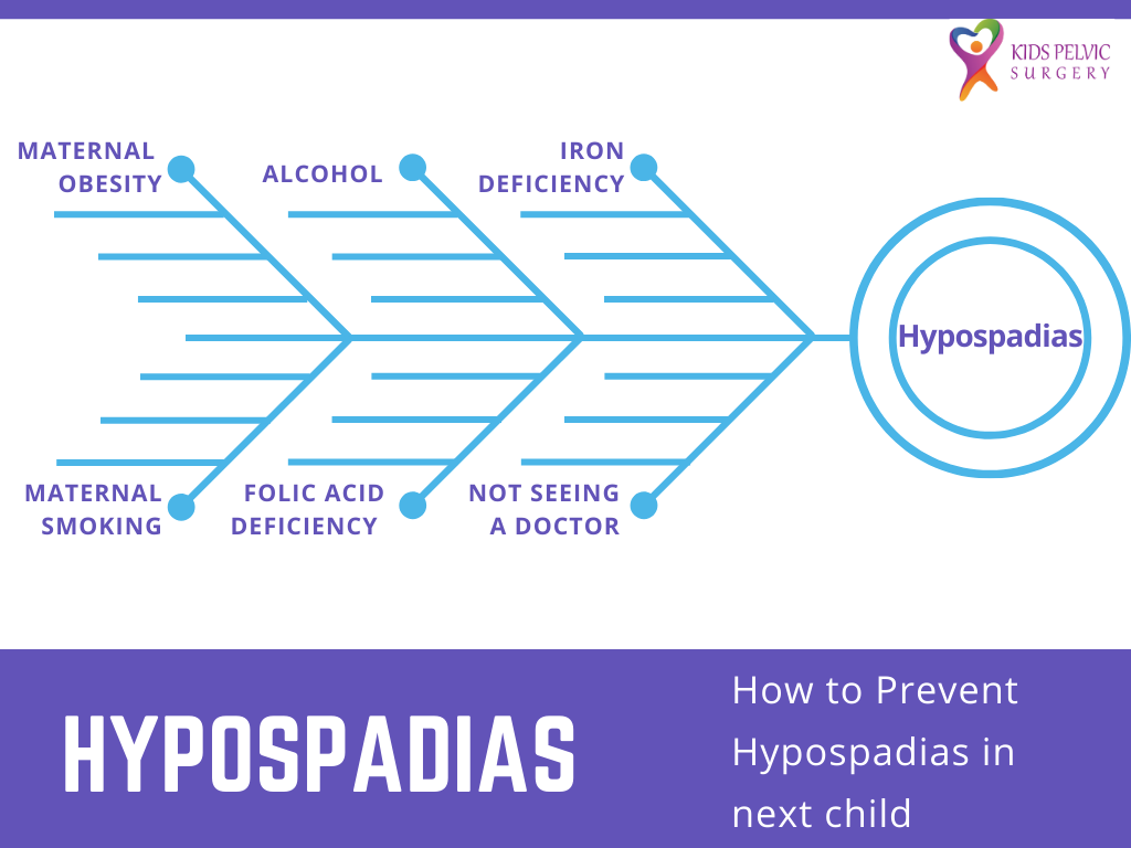 Hypospadias causes